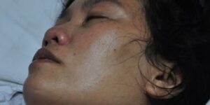 benh-nhan-56255_410x205