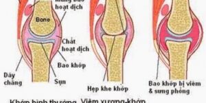 cao xoa bóp giangs chai đỏ