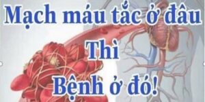 kham-tim-mach2011_410x205