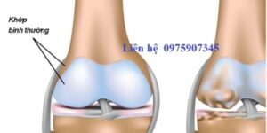 khop-goi0746_410x205