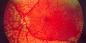 Khám sức khỏe định kỳ theo thông tư mới 1