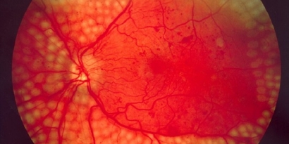 Khám sức khỏe định kỳ theo thông tư mới 1