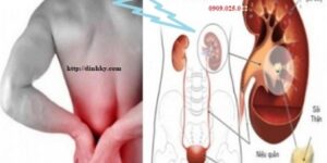 Khám định kỳ nên có siêu âm bụng