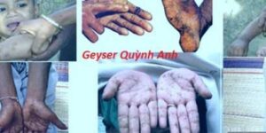 tac-hai-cua-nuoc-o-nhiem5060_410x2056729_410x205