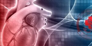 tim-mach0780_410x205